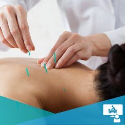woman receiving an Acupuncture treatment