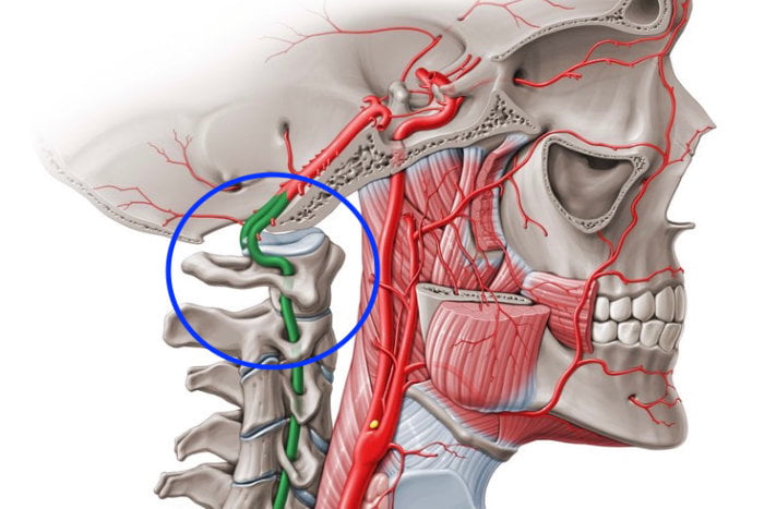 Tensile Force in the Vertebral Arteries During Cervical Spine Manipulation Applied to Human Cadavers