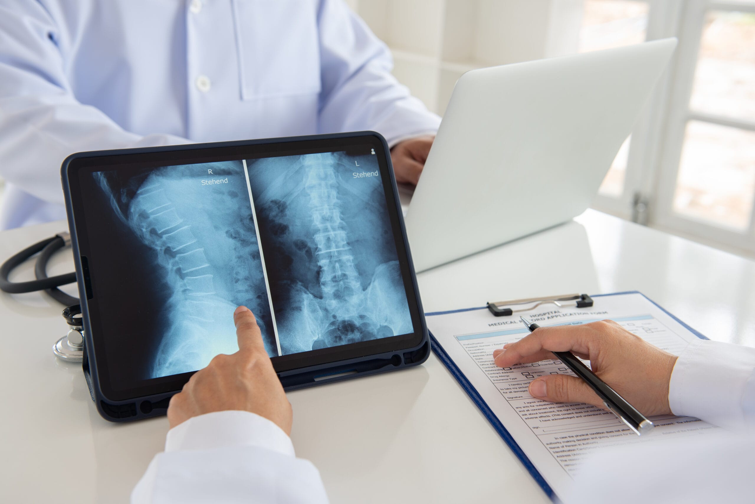 Lumbar spine x-ray images in an iPad on a doctor's desk